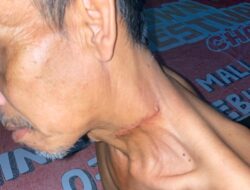 Pelaku Yang Berniat Menghbisi Tetangganya Di Malino, Korban Belum Tahu Motifnya Sehingga Ingin Menghabisi Nyawanya